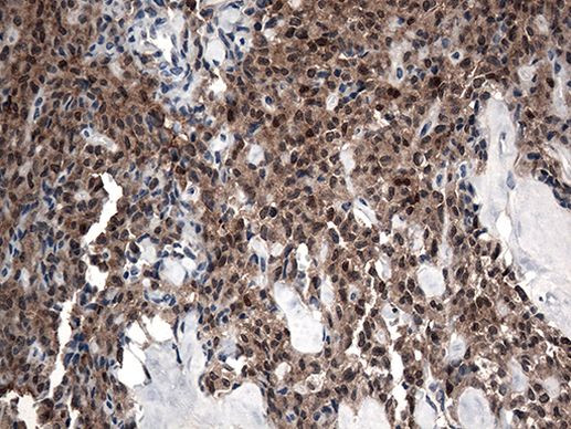 CSTB Antibody in Immunohistochemistry (Paraffin) (IHC (P))