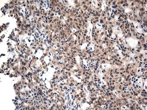 CSTB Antibody in Immunohistochemistry (Paraffin) (IHC (P))
