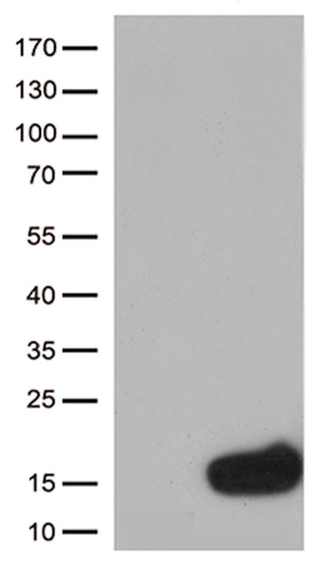 CSTB Antibody in Western Blot (WB)
