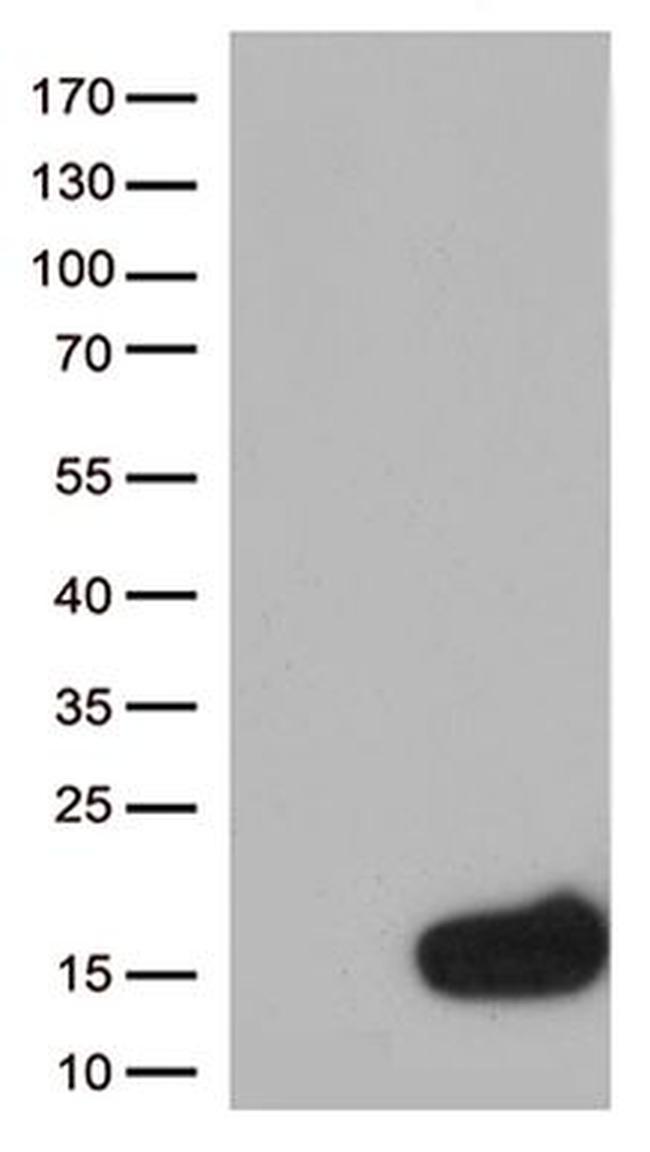 CSTB Antibody in Western Blot (WB)