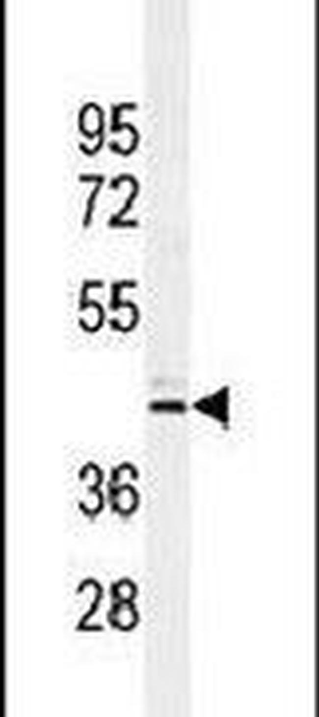 CT112 Antibody in Western Blot (WB)