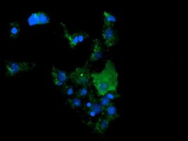 CTAG1B Antibody in Immunocytochemistry (ICC/IF)