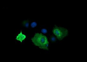 CTAG1B Antibody in Immunocytochemistry (ICC/IF)