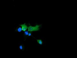 CTAG1B Antibody in Immunocytochemistry (ICC/IF)