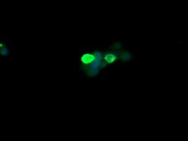 CTAG1B Antibody in Immunocytochemistry (ICC/IF)