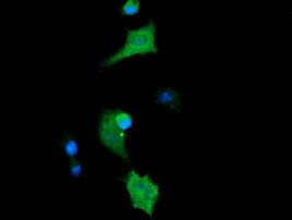 CTAG1B Antibody in Immunocytochemistry (ICC/IF)
