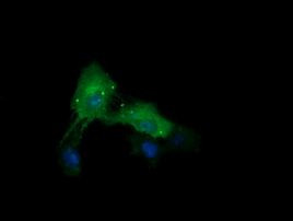 CTAG1B Antibody in Immunocytochemistry (ICC/IF)