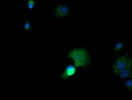 CTAG1B Antibody in Immunocytochemistry (ICC/IF)