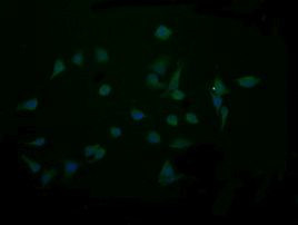 CTAG1B Antibody in Immunocytochemistry (ICC/IF)