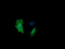 CTAG1B Antibody in Immunocytochemistry (ICC/IF)