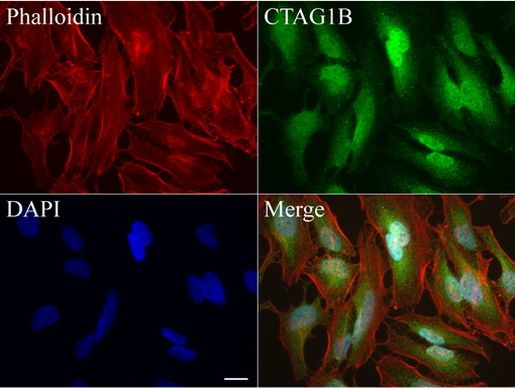 CTAG1B Antibody in Immunocytochemistry (ICC/IF)