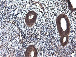 CTAG1B Antibody in Immunohistochemistry (Paraffin) (IHC (P))