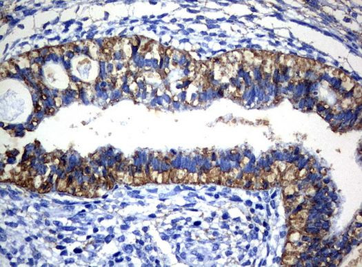 CTAG1B Antibody in Immunohistochemistry (Paraffin) (IHC (P))