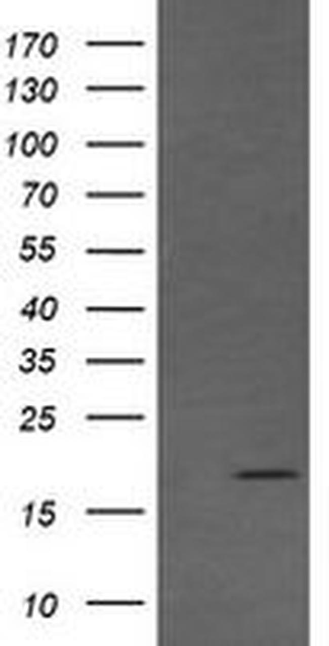 CTAG1B Antibody in Western Blot (WB)