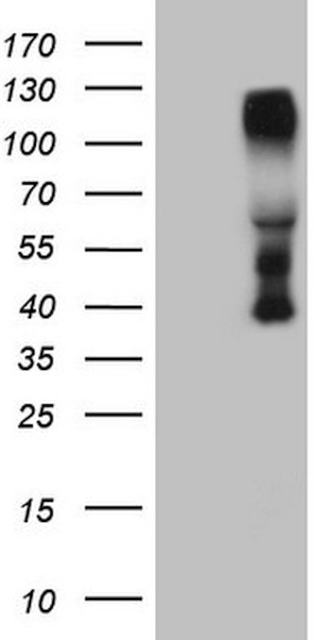 CTBP2 Antibody in Western Blot (WB)