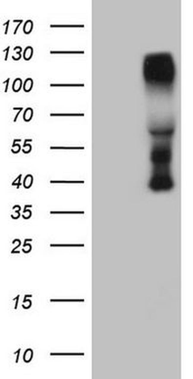 CTBP2 Antibody in Western Blot (WB)