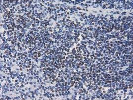 CTDSP1 Antibody in Immunohistochemistry (Paraffin) (IHC (P))