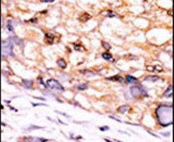CTDSP1 Antibody in Immunohistochemistry (IHC)
