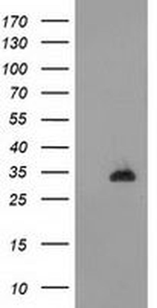 CTDSP1 Antibody in Western Blot (WB)