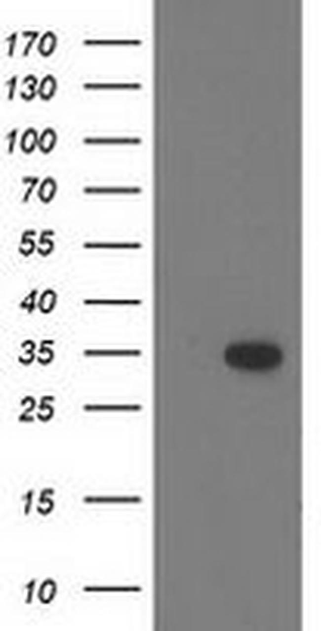 CTDSP1 Antibody in Western Blot (WB)
