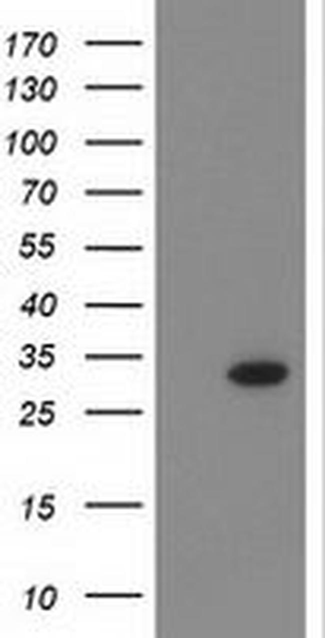CTDSP1 Antibody in Western Blot (WB)