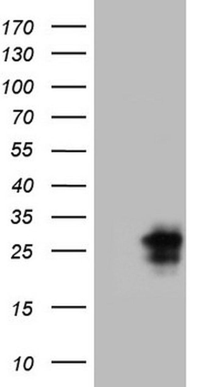 CTLA4 Antibody in Western Blot (WB)