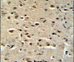 Catenin alpha-1 Antibody in Immunohistochemistry (IHC)