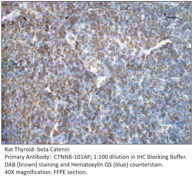 beta Catenin Antibody in Immunohistochemistry (IHC)