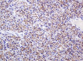 CTNND1 Antibody in Immunohistochemistry (Paraffin) (IHC (P))