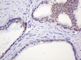 CTNND1 Antibody in Immunohistochemistry (Paraffin) (IHC (P))