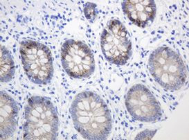 CTNND1 Antibody in Immunohistochemistry (Paraffin) (IHC (P))