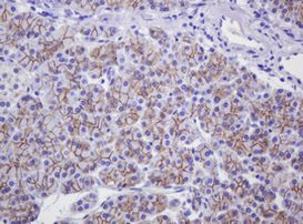 CTNND1 Antibody in Immunohistochemistry (Paraffin) (IHC (P))