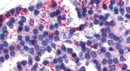 Calcitonin Receptor Antibody in Immunohistochemistry (Paraffin) (IHC (P))