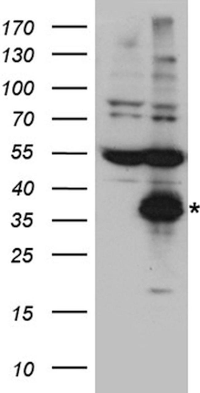 CTRL Antibody in Western Blot (WB)
