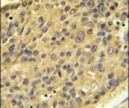 Cathepsin H Antibody in Immunohistochemistry (IHC)