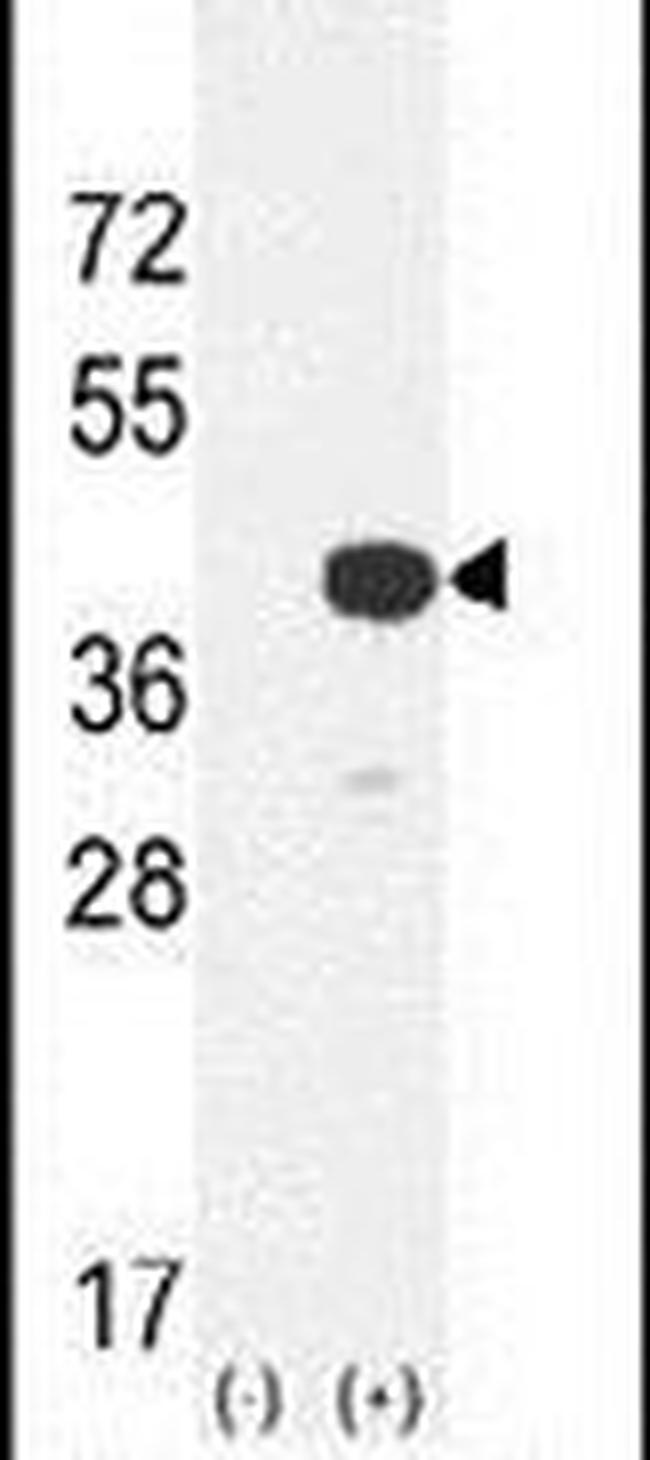 Cathepsin K Polyclonal Antibody (PA5-14270)