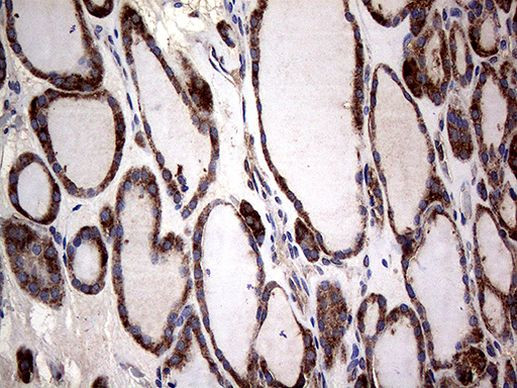 CTSL1 Antibody in Immunohistochemistry (Paraffin) (IHC (P))