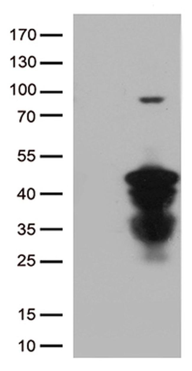 CTSL1 Antibody in Western Blot (WB)