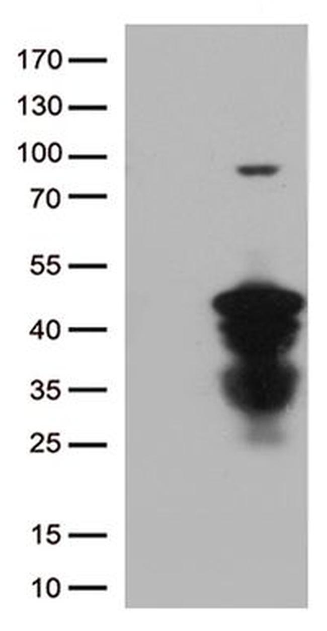 CTSL1 Antibody in Western Blot (WB)