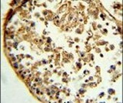 Cathepsin S Antibody in Immunohistochemistry (IHC)