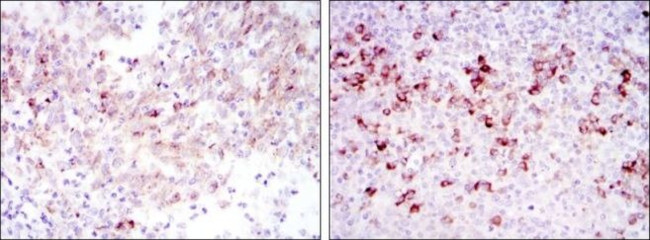 Cortactin Antibody in Immunohistochemistry (Paraffin) (IHC (P))