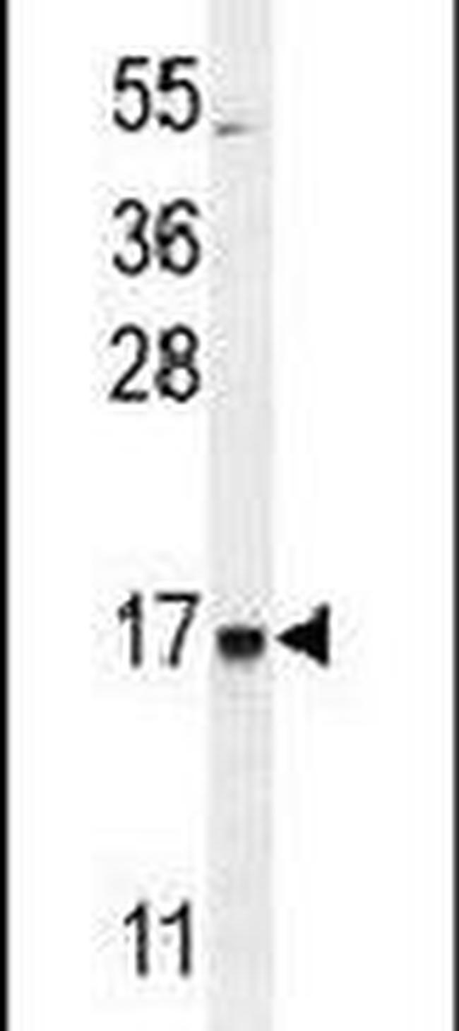 C21orf2 Antibody in Western Blot (WB)