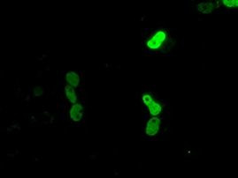 CUGBP1 Antibody in Immunocytochemistry (ICC/IF)