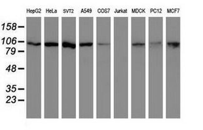 CUL4B Antibody in Western Blot (WB)