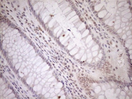 CWC27 Antibody in Immunohistochemistry (Paraffin) (IHC (P))