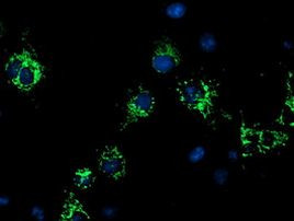 CYB5R1 Antibody in Immunocytochemistry (ICC/IF)