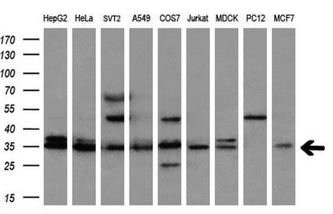CYB5R2 Antibody in Western Blot (WB)