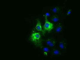 CYB5R3 Antibody in Immunocytochemistry (ICC/IF)