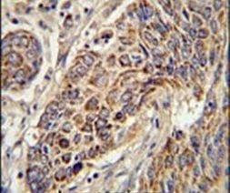 Cytochrome C1 Antibody in Immunohistochemistry (IHC)