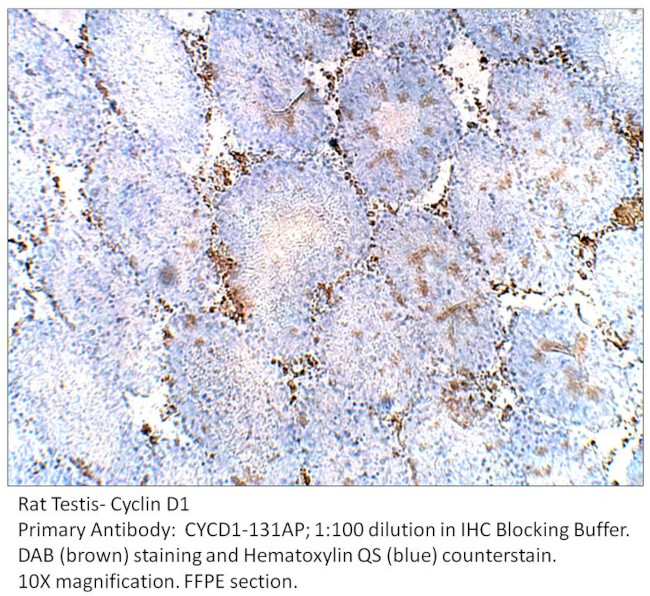 Cyclin D1 Antibody in Immunohistochemistry (IHC)
